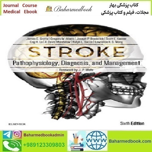 Stroke Pathophysiology Diagnosis and Management 20