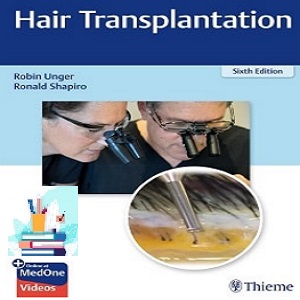 Hair Transplantation TRUE PDF   VIDEOS Price 9€ - کتاب پزشکی بهار
