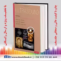 سونوگرافی | Ultrasound