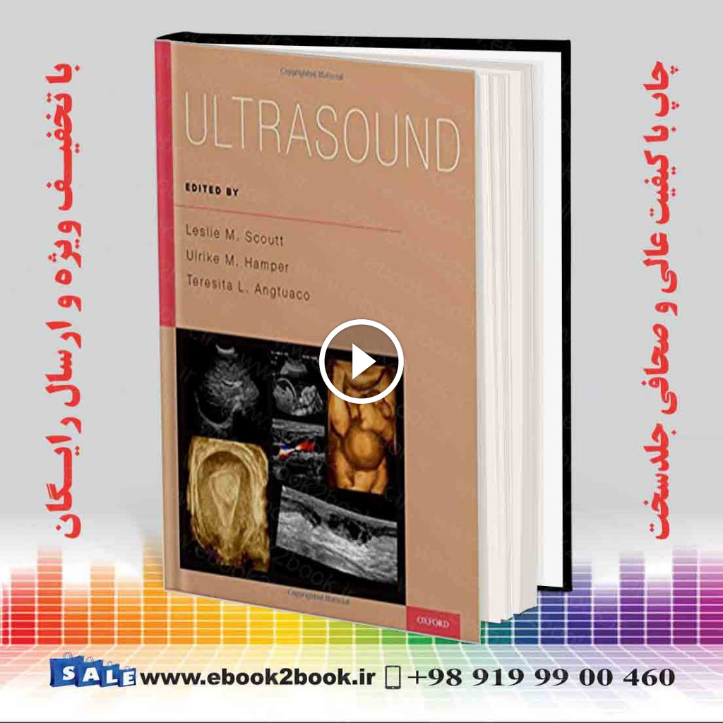 سونوگرافی | Ultrasound