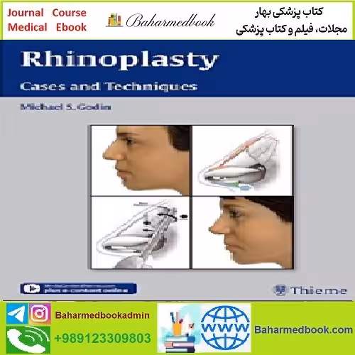 Rhinoplasty Cases and Techniques TRUE PDF price 1€ - کتاب پزشکی بهار