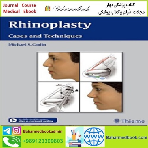 Rhinoplasty Cases and Techniques TRUE PDF price 1€ - کتاب پزشکی بهار