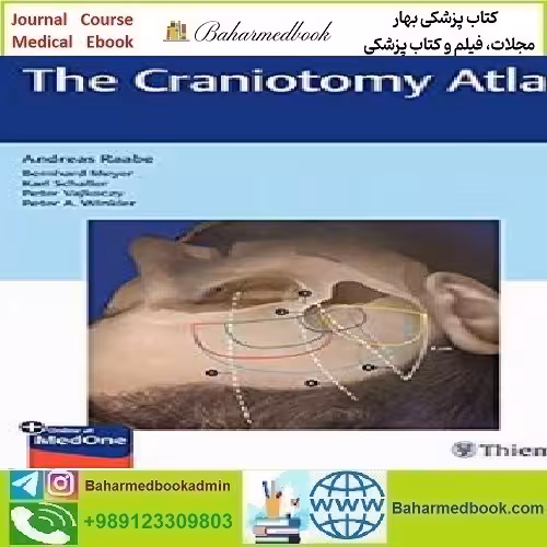 The Craniotomy Atlas 2019 TRUE PDF price 1€ - کتاب پزشکی بهار