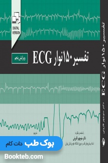 تفسیر 150 نوار ECG
