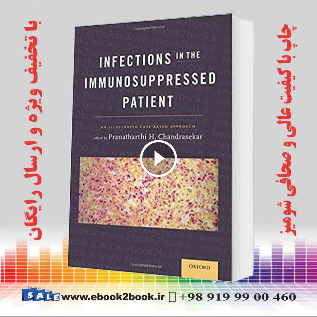 Infections in the Immunosuppressed Patient