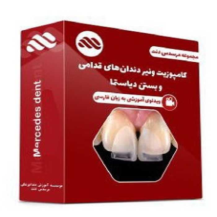 ویدئوی کامپوزیت ونیر دندان های قدامی و بستن دیاستما