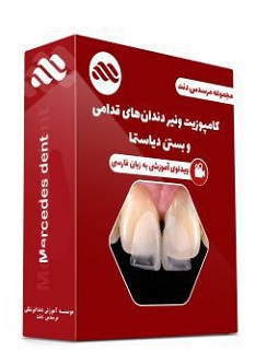 ویدئوی کامپوزیت ونیر دندان های قدامی و بستن دیاستما