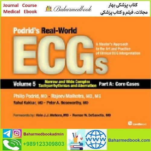 Podrid's Real World ECGs Narrow and Wide Complex Tachyarrhyth