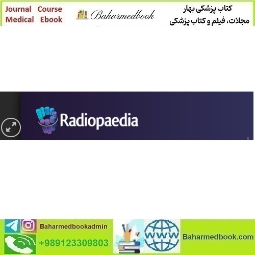 Radiopaedia RADIOLOGY REVIEW COURSE video cour
