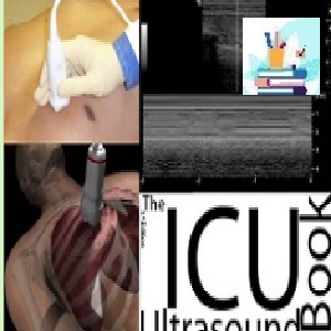 The ICU Ultrasound Pocket Book TRUE PDF price 1€