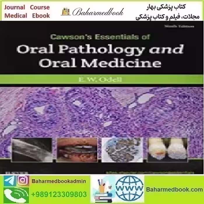 Cawson's Essentials of Oral Pathology and Oral Medici