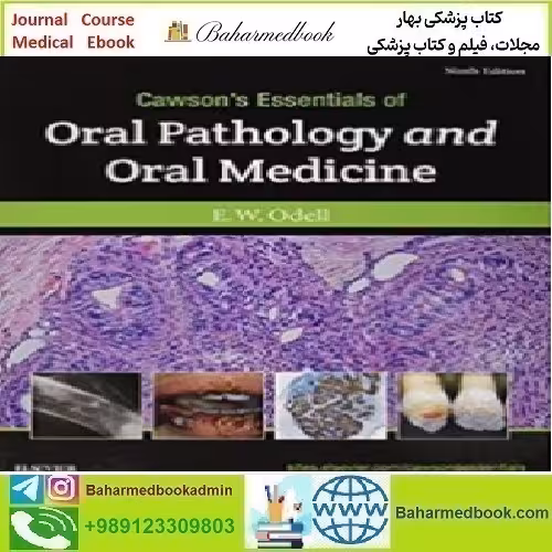 Cawson's Essentials of Oral Pathology and Oral Medici