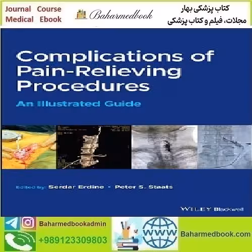 Complications of Pain Relieving Procedures 2022