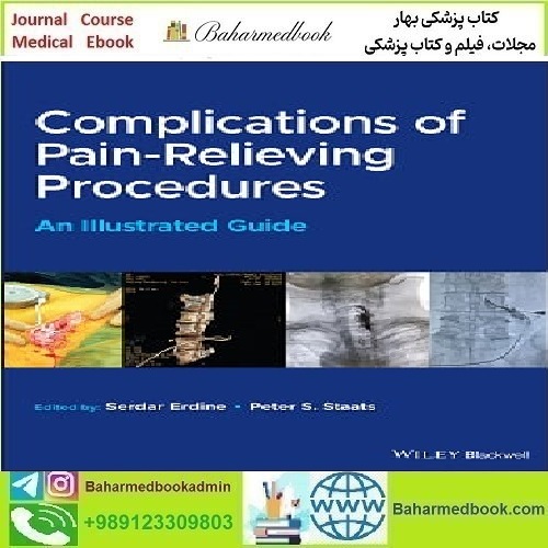 Complications of Pain Relieving Procedures 2022