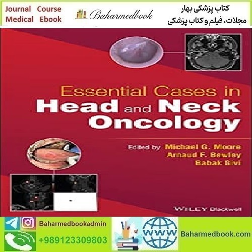 Essential Cases in Head and Neck Oncology 2022