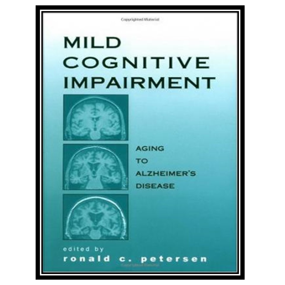 کتاب Mild Cognitive Impairment: Aging to Alzheimers Disease اثر Ronald C Petersen انتشارات مؤلفین طلایی