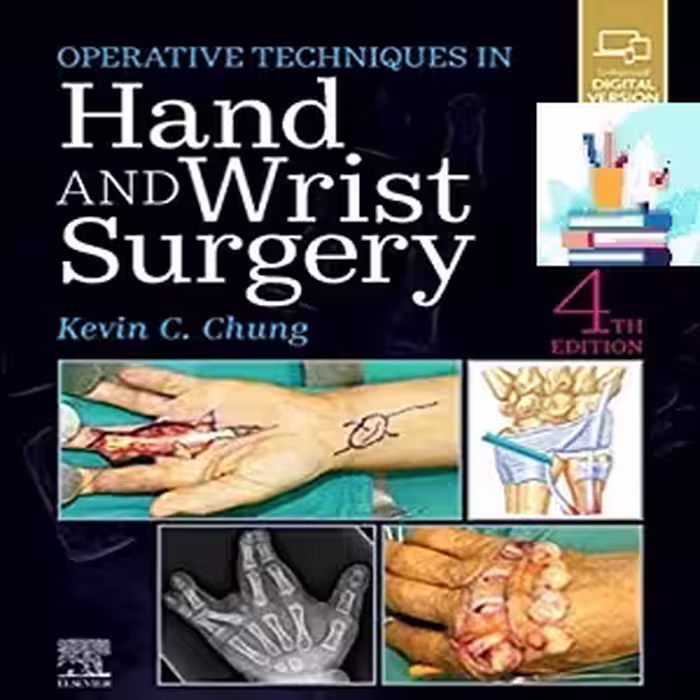 Operative Techniques Hand and Wrist Surgery