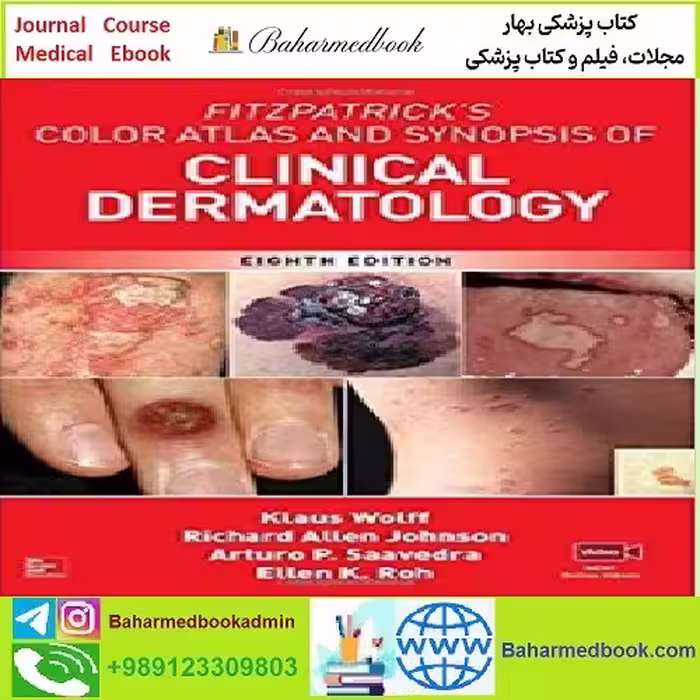 Fitzpatrick's Color Atlas and Synopsis of Clinical Dermatology