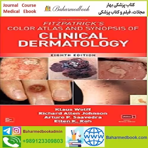 Fitzpatrick's Color Atlas and Synopsis of Clinical Dermatology