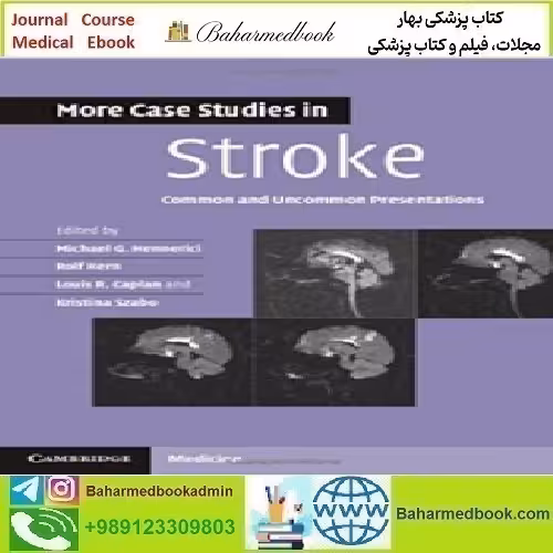 More Case Studies in Stroke Common and Uncommon Presentat