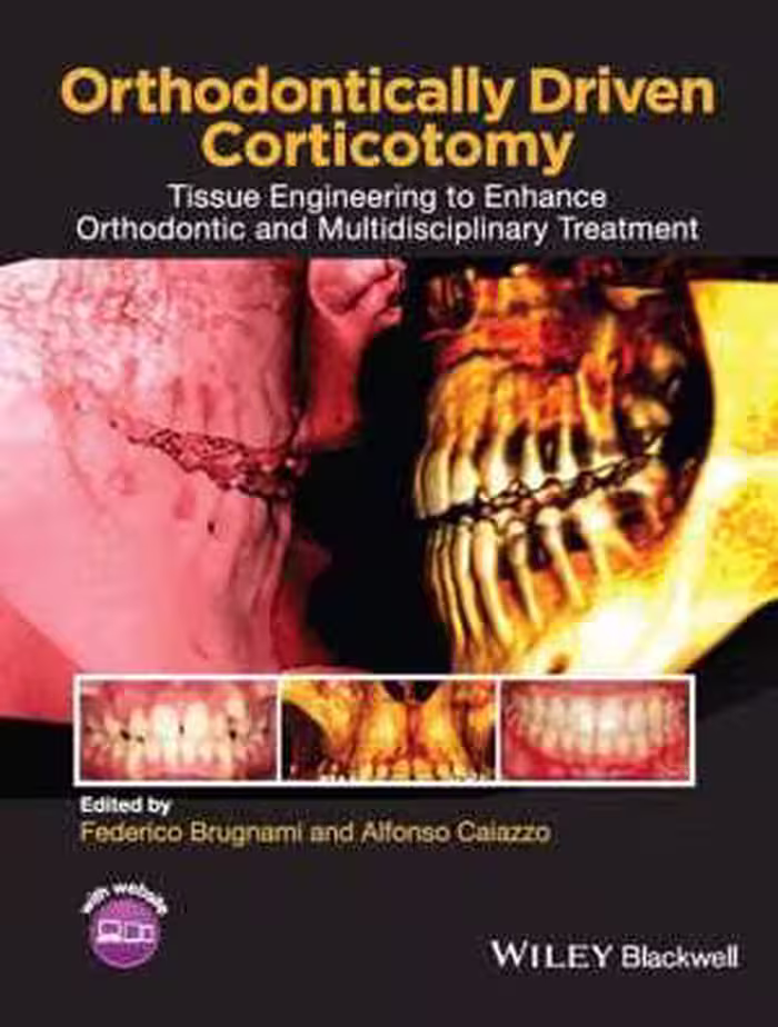 [EPUB] دانلود کتاب Orthodontically Driven Corticotomy - Tissue Engineering To Enhance Orthodontic And Multidisciplinary Treatment, 2015;2014