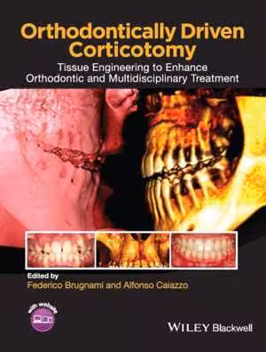 [EPUB] دانلود کتاب Orthodontically Driven Corticotomy - Tissue Engineering To Enhance Orthodontic And Multidisciplinary Treatment, 2015;2014