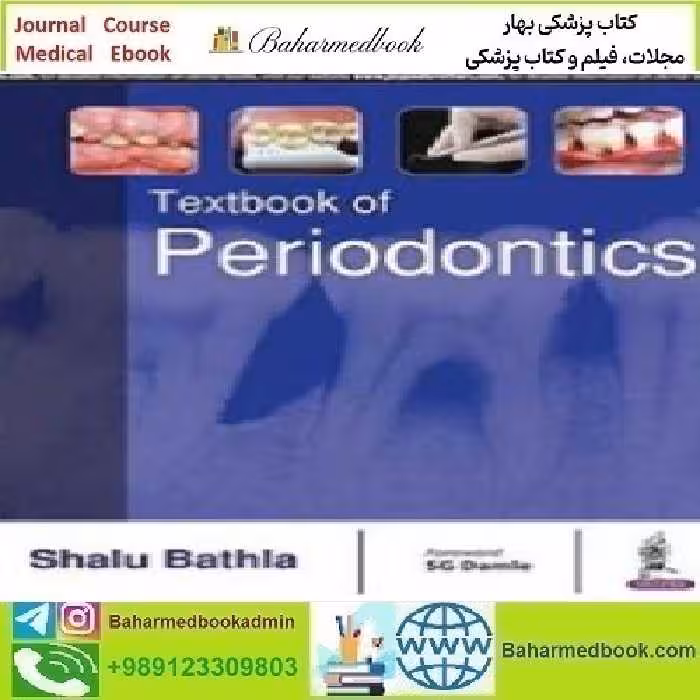 Textbook of Periodontics 2017 TRUE PDF price 1€ - کتاب پزشکی بهار