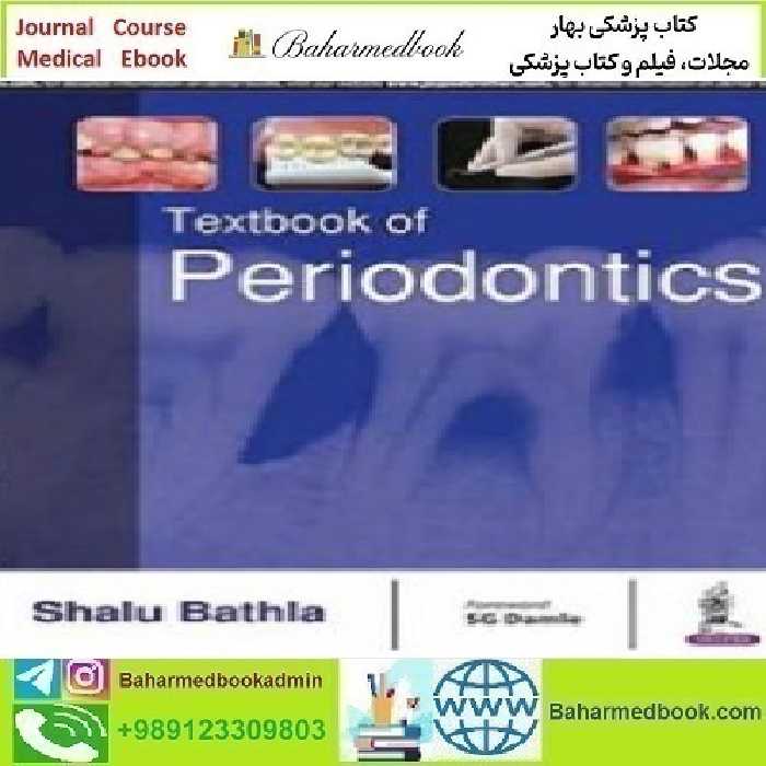 Textbook of Periodontics 2017 TRUE PDF price 1€ - کتاب پزشکی بهار