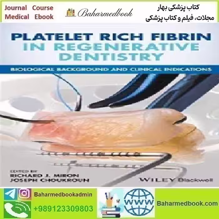 Platelet Rich Fibrin in Regenerative Dentistry 2017 T