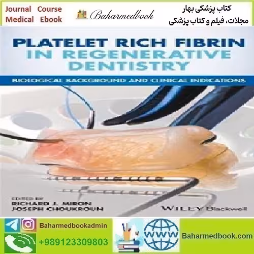Platelet Rich Fibrin in Regenerative Dentistry 2017 T