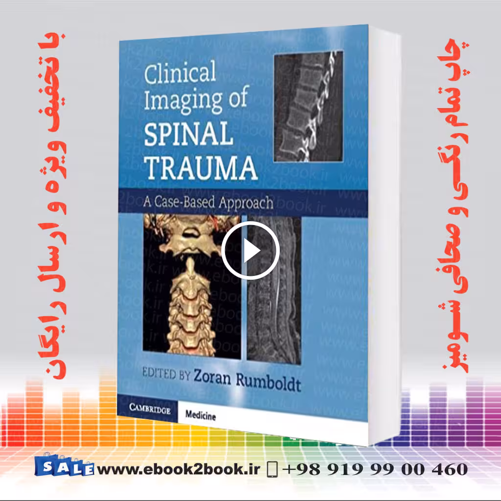 Clinical Imaging of Spinal Trauma
