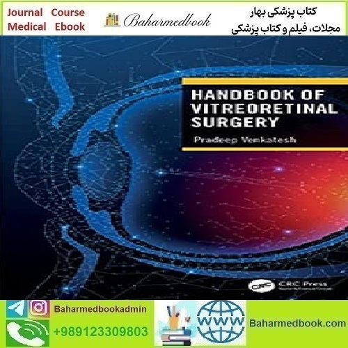 Handbook of Vitreoretinal Surgery 2023 TRUE PDF price 1€ - کتاب پزشکی بهار