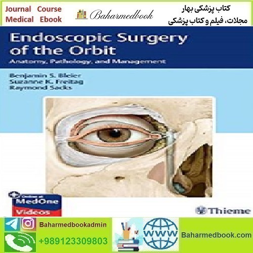 Endoscopic Surgery of the Orbit Anatomy Pathology and M