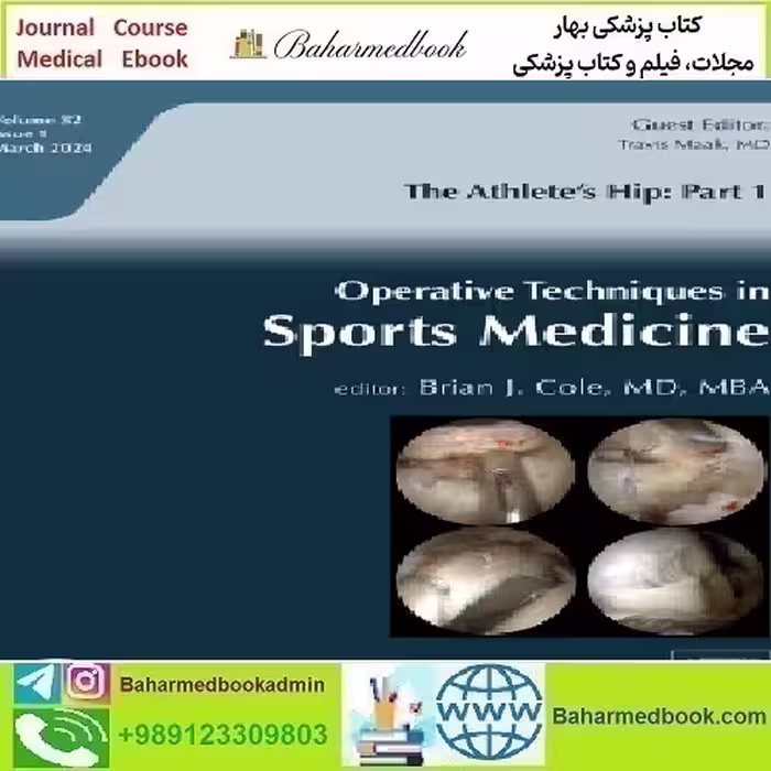Operative Techniques in Sports Medicine Volume 32 Issue 1 202