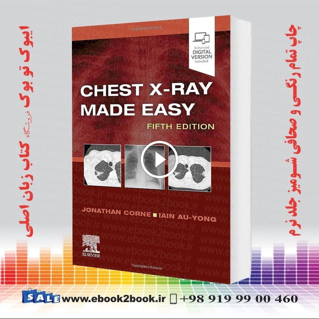 Chest X-Ray Made Easy 5th Edition
