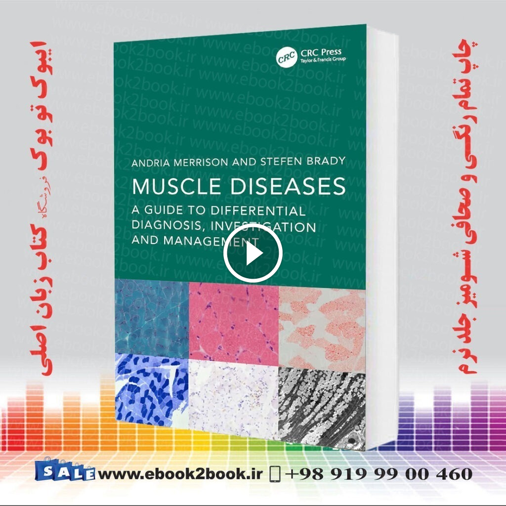 Muscle Diseases