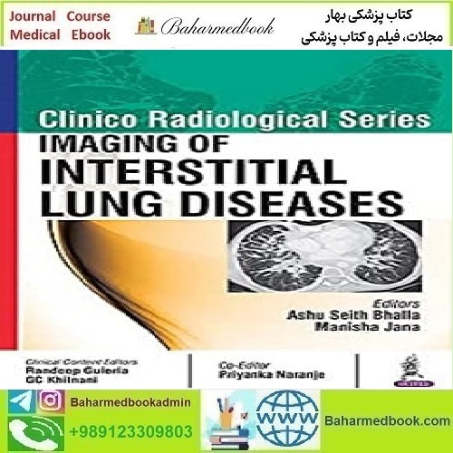 Clinico Radiological Series Imaging of Interstitial Lung