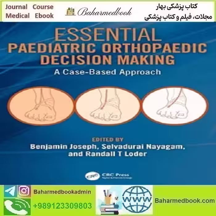 Essential Paediatric Orthopaedic Decision Making دانلود کتاب الکترونیکی