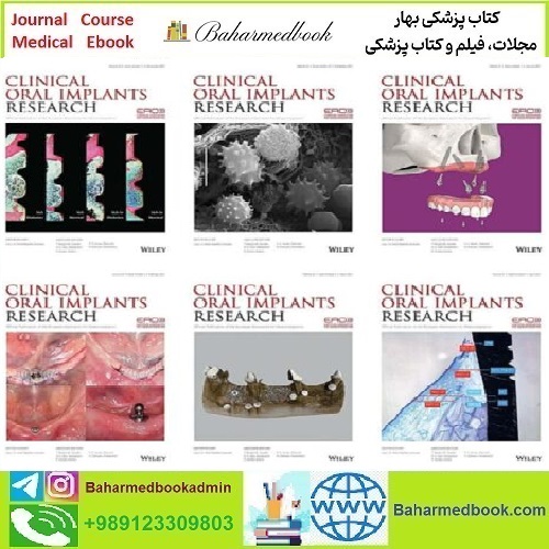 Clinical Oral Implants Research 2021 Full Archives TRUE PDF