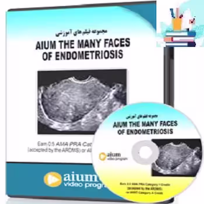 AIUM The Many Faces of Endometriosis at 10€ - کتاب پزشکی بهار