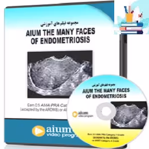 AIUM The Many Faces of Endometriosis at 10€ - کتاب پزشکی بهار