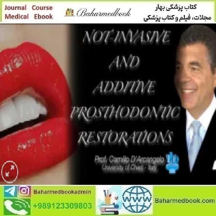 Non Invasive and Additive Prosthodontics Restoratio