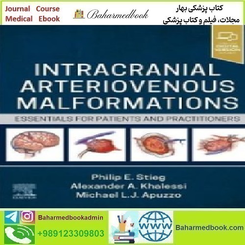 Intracranial Arteriovenous Malformations Essen