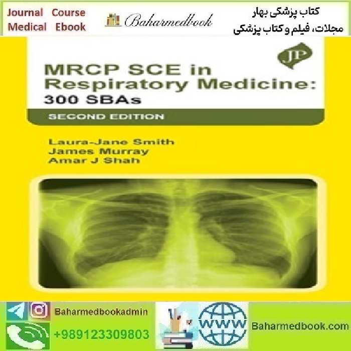 MRCP SCE in Respiratory Medicine 300 SBAs 2023 TRUE PD