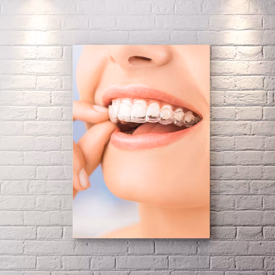 تابلو شاسی دکوراتیو دندان پزشکی طرح لبخند زیبا BAs-8570