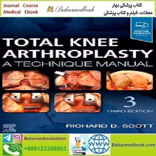 Total Knee Arthroplasty A Technique Manual 2020 TRUE PDF