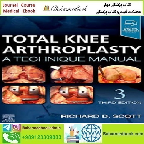 Total Knee Arthroplasty A Technique Manual 2020 TRUE PDF