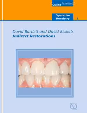 [EPUB] دانلود کتاب Indirect Restorations - Quintessentials Of Dental Practice Vol. 25, 2010