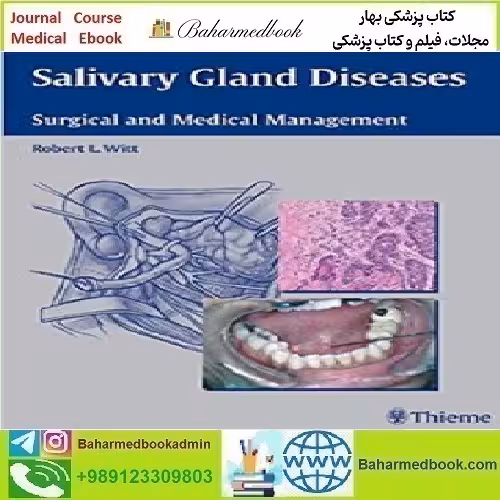 Salivary Gland Diseases Surgical and Medical Management