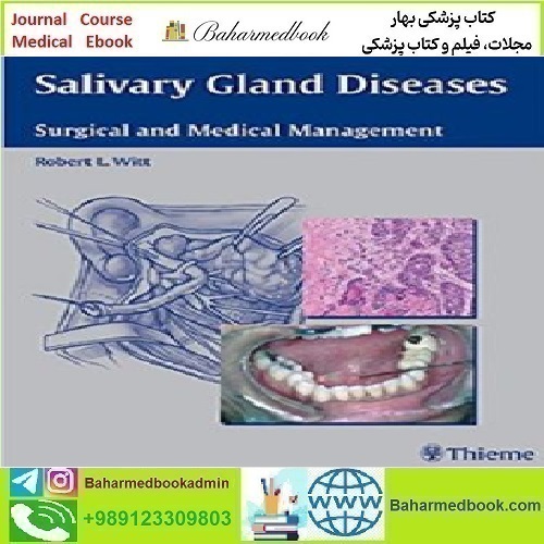 Salivary Gland Diseases Surgical and Medical Management